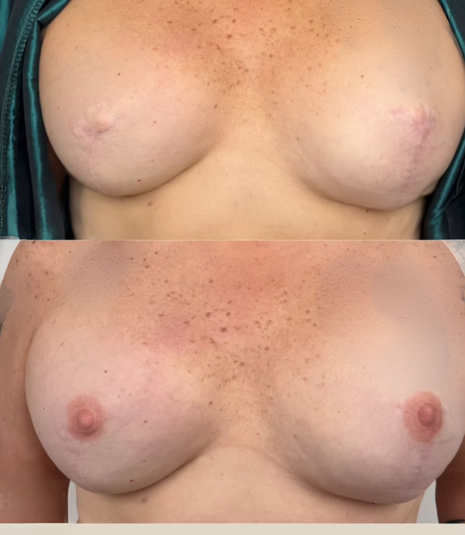 Restorative procedure result